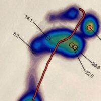 digitaler Foßabdruck, nach dem Einlagen in der Schuhtechnik der Orthopädietechnik Nord maßgefertigt werden